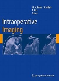 copertina di Intraoperative Imaging