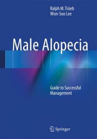 copertina di Male Alopecia : Guide to Successful Management