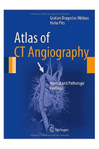 copertina di Atlas of CT ( Computed Tomography ) Angiography - Normal and Pathologic Findings