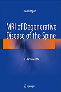 copertina di MRI ( Magnetic Resonance Imaging ) of Degenerative Disease of the Spine - A Case ...