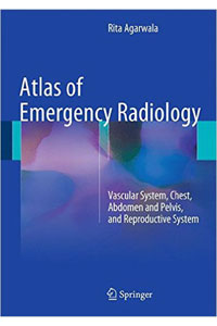 copertina di Atlas of Emergency Radiology - Vascular System, Chest, Abdomen and Pelvis, and Reproductive ...