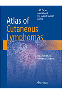 copertina di Atlas of Cutaneous Lymphomas - Classification and Differential Diagnosis