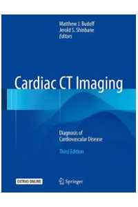 copertina di Cardiac CT (Computed Tomography) Imaging - Diagnosis of Cardiovascular Disease