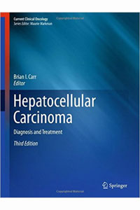copertina di Hepatocellular Carcinoma - Diagnosis and Treatment