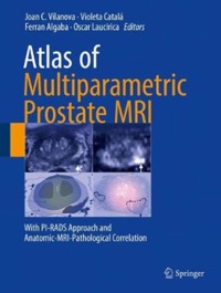 copertina di Atlas of Multiparametric Prostate MRI ( Magnetic Resonance Imaging ) With PI - RADS ...