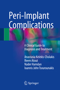 copertina di Peri - Implant Complications - A Clinical Guide to Diagnosis and Treatment