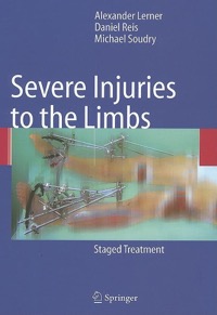 copertina di Severe Injuries to the Limbs - Staged Treatment