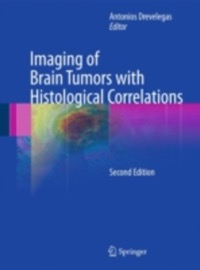 copertina di Imaging of Brain Tumors with Histological Correlations