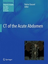 copertina di CT of the Acute Abdomen