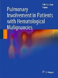 copertina di Pulmonary Involvement in Patients with Hematological Malignancies