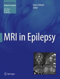 copertina di MRI ( Magnetic Resonance Imaging ) in Epilepsy