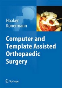 copertina di Computer and Template Assisted Orthopedic Surgery