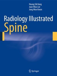 copertina di Radiology Illustrated - Spine