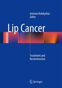 copertina di Lip Cancer - Treatment and Reconstruction