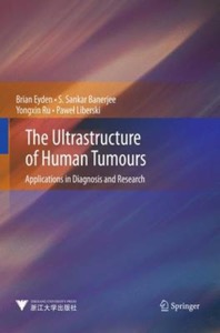 copertina di The Ultrastructure of Human Tumours : Applications in Diagnosis and Research