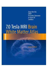 copertina di 7.0 Tesla MRI ( Magnetic Reonance Imaging ) Brain Atlas - In Vivo Atlas with Cryomacrotome ...