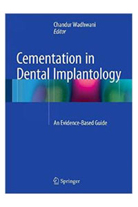 copertina di Cementation in Dental Implantology: An Evidence - Based Guide