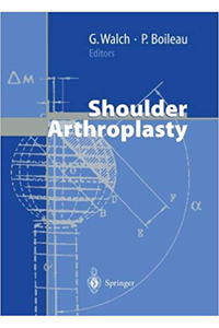 copertina di Shoulder Arthroplasty