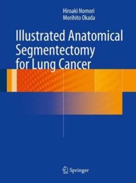 copertina di Illustrated Anatomical Segmentectomy for Lung Cancer