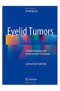copertina di Eyelid Tumors - Clinical Evaluation and Reconstruction Techniques