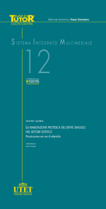 copertina di DVD MTO 12 La riabilitazione protesica del dente singolo nel settore estetico - Ricostruzione ...