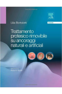 copertina di Trattamento protesico rimovibile su ancoraggi naturali e artificiali