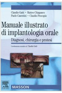copertina di Manuale illustrato di implantologia orale - diagnosi - chirurgia e protesi