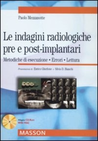 copertina di Le indagini radiologiche pre e post - implantari - Metodiche di esecuzione, errori, ...