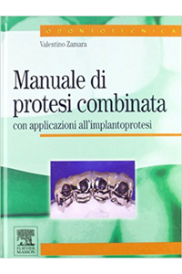 copertina di Manuale di protesi combinata con applicazioni all' implantoprotesi