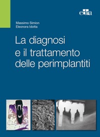 copertina di La diagnosi e il trattamento delle perimplantiti