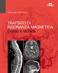 copertina di Trattato di Risonanza Magnetica ( RM ) Cranio e rachide