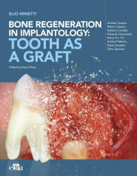 copertina di Bone regeneration in implantology : tooth as a graft