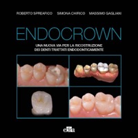 copertina di Endocrown - Una nuova via per la ricostruzione dei denti trattati endodonticamente