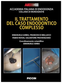 copertina di Il trattamento del caso Endodontico Complesso