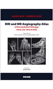 copertina di MRI ( Magnetic Resonance Imaging ) and MR ( Magnetic Resonance ) Angiography Atlas ...