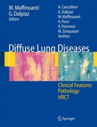 copertina di Diffuse lung diseases - Clinical features, pathology, HRCT