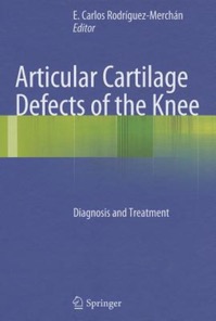 copertina di Articular Cartilage Defects of the Knee - Diagnosis and Treatment