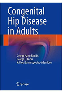copertina di Congenital Hip Disease ( CHD ) in Adults