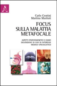 copertina di Focus sulla malattia metafocale - Aspetti etiopatogenetici e clinici - Descrizione ...