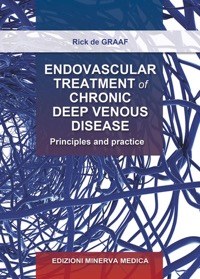 copertina di Endovascular treatment of chronic deep venous disease - Principles and practice