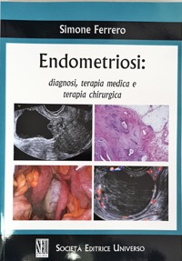 copertina di Endometriosi : diagnosi , terapia medica e terapia chirurgica
