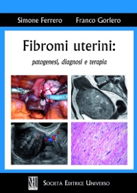 copertina di Fibromi uterini : patogenesi , diagnosi e terapia