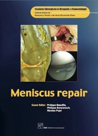 copertina di Meniscus repair