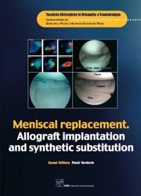 copertina di Meniscal replacement - Allograft implantation and synthetic substitution (in lingua ...