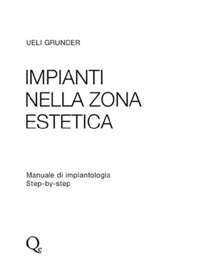 copertina di Impianti nella zona estetica - Manuale di implantologia step by step