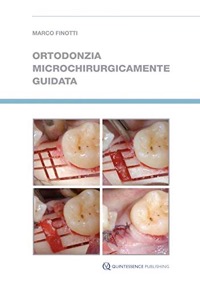 copertina di Ortodonzia microchirurgicamente guidata