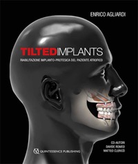 copertina di Tilted implants - Riabilitazione impianto - protesica del paziente atrofico