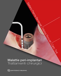 copertina di Malattie peri - implantari - Trattamenti chirurgici