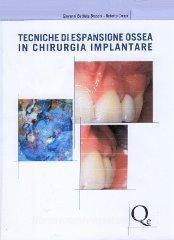 copertina di Tecniche di espansione ossea in chirurgia implantare