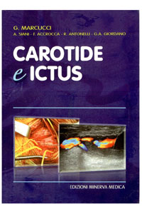 copertina di Carotide e ictus